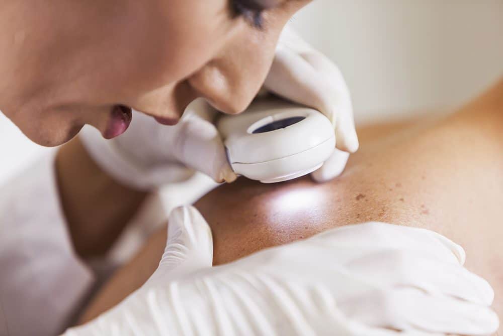 Dermatologist examining patient for signs of skin cancer