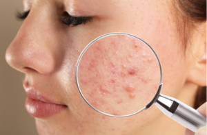 Teenage girl with acne problem visiting dermatologist