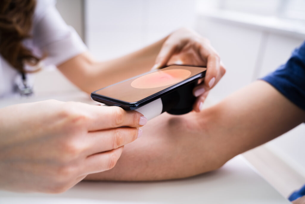 A doctor looking for signs of skin cancer on a patient’s arm