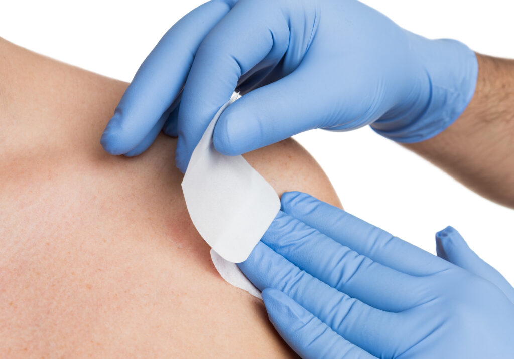 Nurse hand patching mole removal surgery incision as epidermal birthmark concept